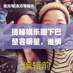 揭秘娛樂圈下巴整容明星，誰悄悄整過下巴？