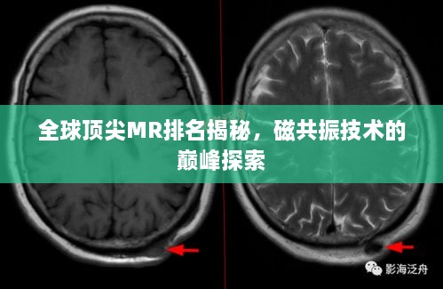 全球頂尖MR排名揭秘，磁共振技術的巔峰探索