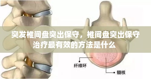 突發(fā)椎間盤突出保守，椎間盤突出保守治療最有效的方法是什么 