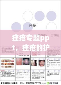 痤瘡專題ppt，痤瘡的護理ppt 