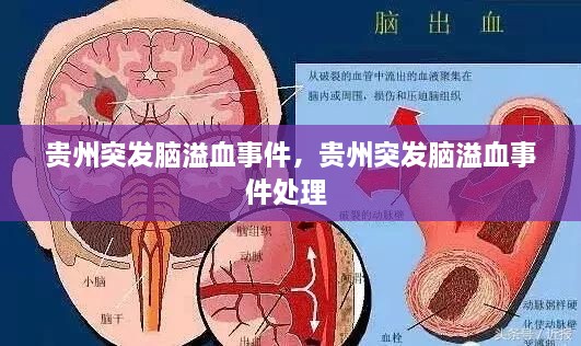 貴州突發(fā)腦溢血事件，貴州突發(fā)腦溢血事件處理 